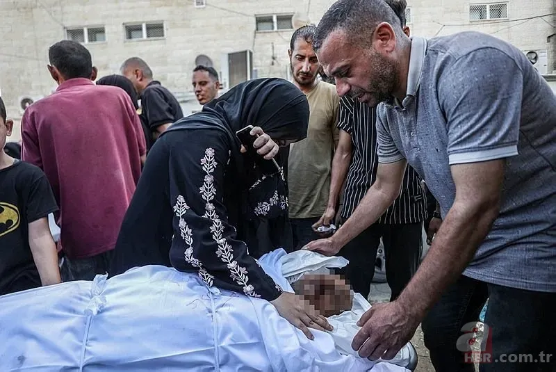 ABD'li doktor soykırımcı İsrail'in acımasızlığını herkese duyurdu: Karnından ve göğsünden vurulmuş çocuklar gördüm 5