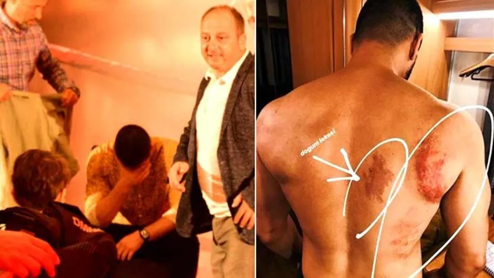 Tolgahan Sayışman ‘Şampiyon’un yayın gecesinde fenalaştı