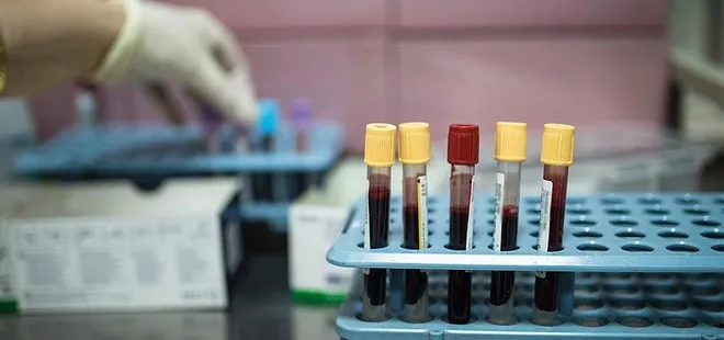 Türk bilim insanları kanserle savaşacak uyuyan hücrelerin şifrelerini keşfetti | Prof. Dr. Güneş Esendağlı’dan önemli açıklamalar