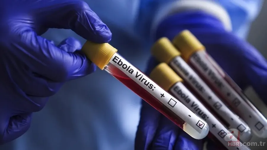 Ebola salgını hızla yayılıyor! Batı ülkeleri yardım bütçelerini kesti, küresel risk kapıda 3
