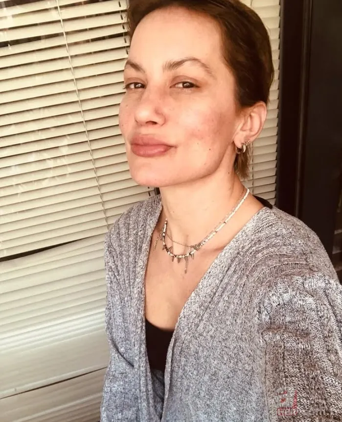 Yıldız Asyalı'nın eşinden açıklama geldi! "Kocam beni darp etti" demişti... 3