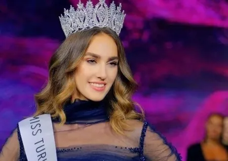 Büyük değişim! Miss Turkey 1. İdil Bilgen'in son hali şaşırttı