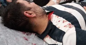 Usulsüzlükleri ifşa etti! Yaşam savaşı veriyor