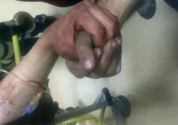 Yaralı kahraman Mehmetçikler göz yaşarttı!