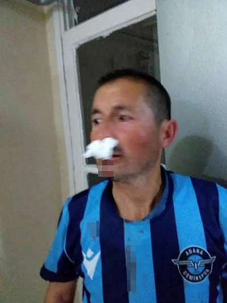 Adana’da işitme engelli adama cadde ortasında feci dayak - 2