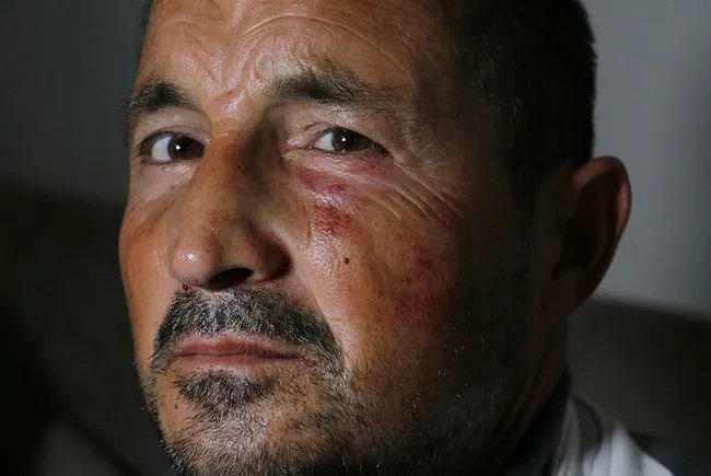 Adana’da işitme engelli adama cadde ortasında feci dayak - 3