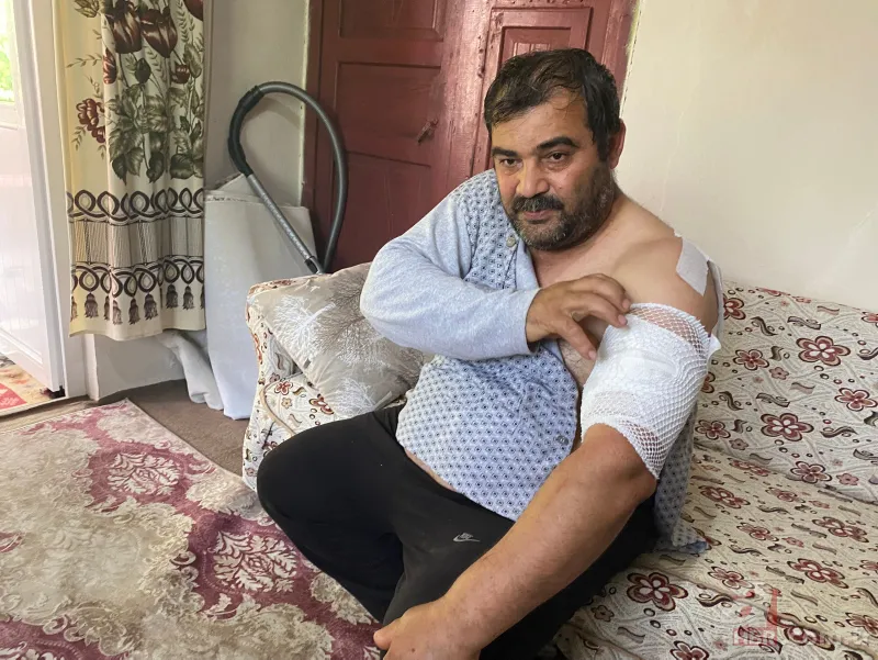 Bartın'da ayı saldırısı! 65 dikiş atıldı: Öldüğümü sanıp bıraktı 13