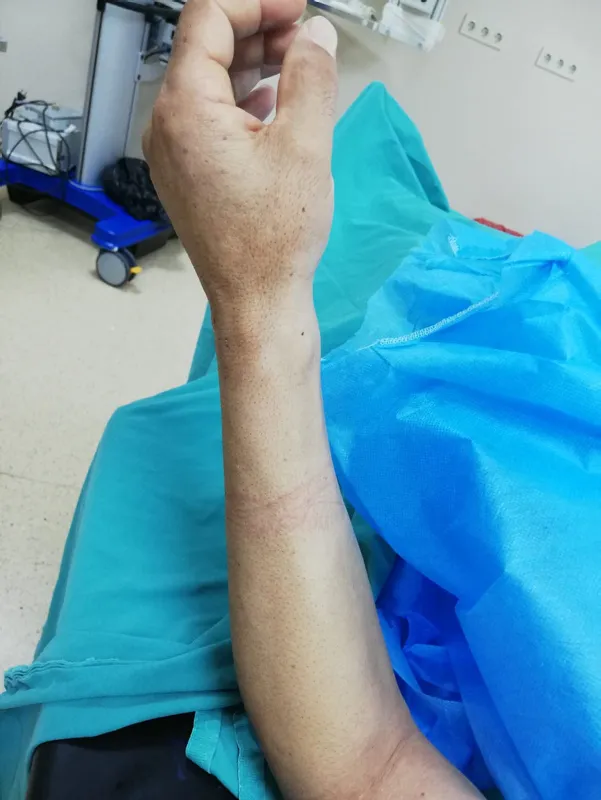 Dünyada çok nadir görülüyor! 'Kist hidatik' ameliyatı Diyarbakır'da yapıldı | 'Kist hidatik' nedir? - 2