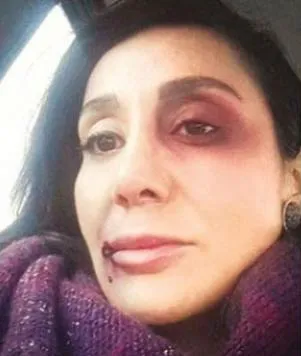 Saruhan Hünel muhabir Eda Sönmez’e şiddet uyguladığı iddia edilen davadan beraat etti