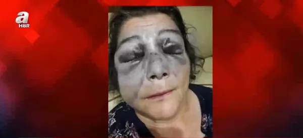 tacize-tecavuze-sessiz-kalan-chp-kendine-tepki-gosteren-kadinlari-da-darp-ediyor-iste-chpnin-kadina-siddet-vakalari-1630482860849.jpg Tacize tecavüze sessiz kalan CHP kendine tepki gösteren kadınları da darp ediyor! İşte CHP'nin kadına şiddet vakaları - 2