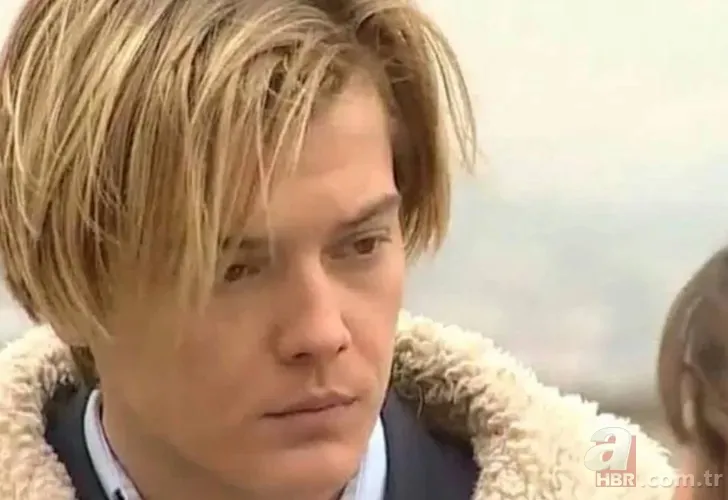 Arda Kural’ın son hali pes dedirtti! 20 kilo verip saç ektirmişti... 1