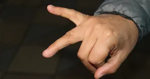 Balıkla dövüp çuprayla parmağını kırdılar