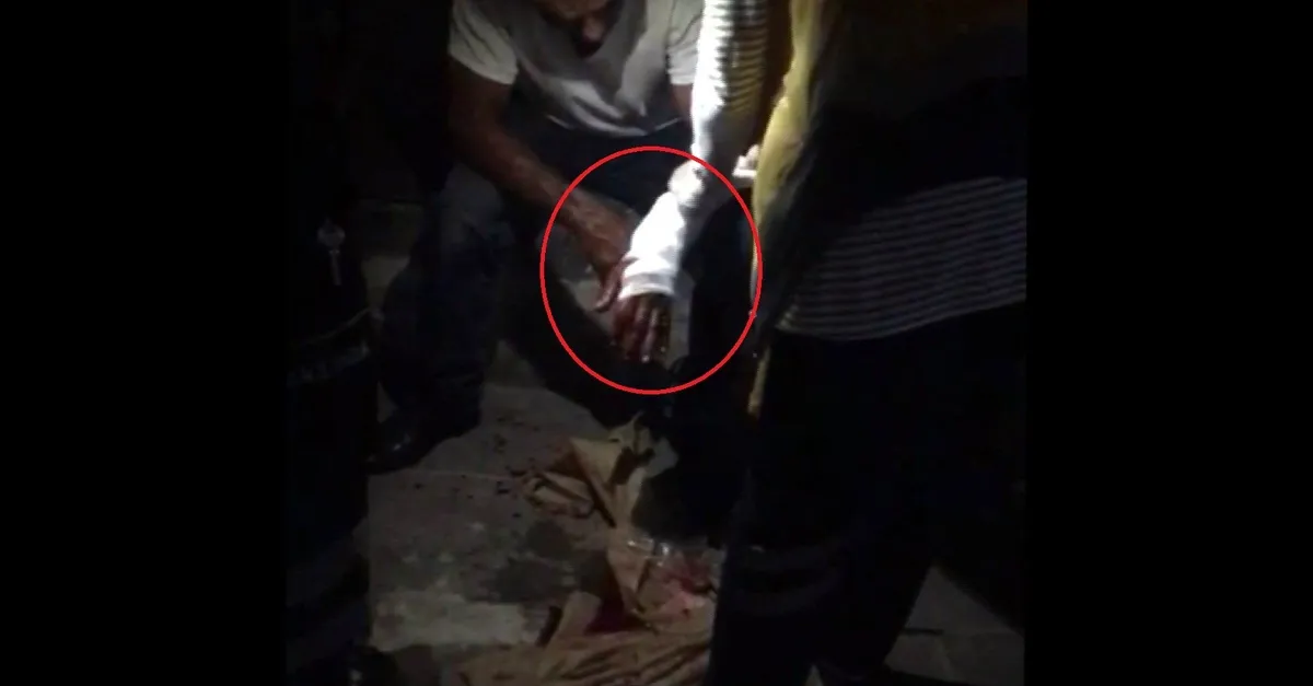 Uyardığı kadın tarafından bıçaklandı