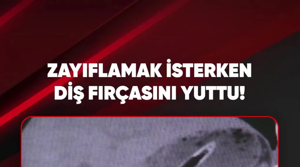 ZAYIFLAMAK İSTERKEN DİŞ FIRÇASINI YUTTU