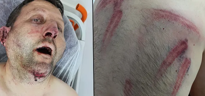 CHP’li Kula Belediye Başkanı Dönmez’den skandal! Makam odasında darp iddiasına gözaltı | Adliyeye sevk edildi