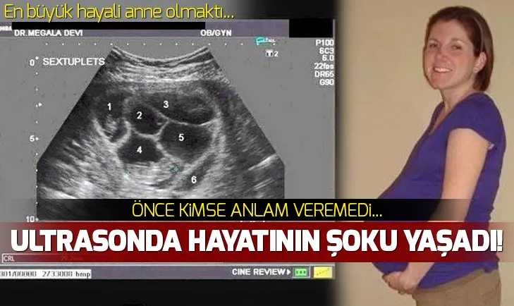 Ultrasona girdi hayatının şokunu yaşadı