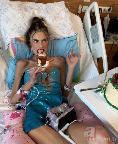 25 kiloya düşen Nihal Candan yoğun bakıma alındı: "Sağlık durumu kritik" 4