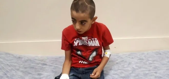 9 yaşındaki çocuğun eline şiş saplandı