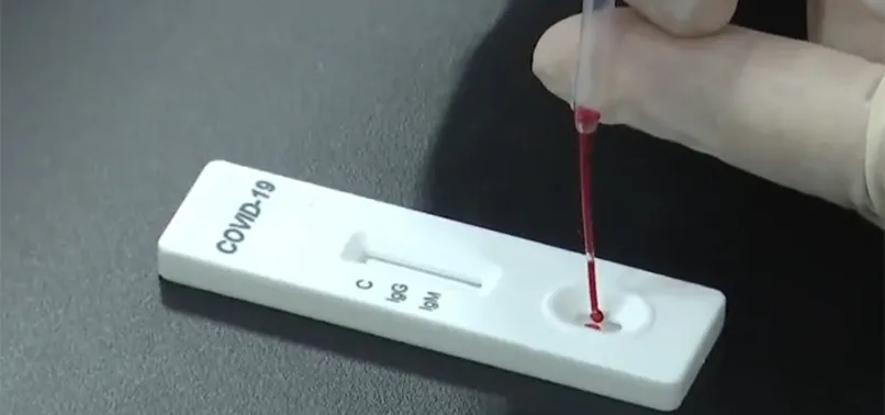 Koronavirüs hakkında müjde gibi haber! Tam kapanma etkisini gösterdi testlerin pozitif çıkma oranı düştü