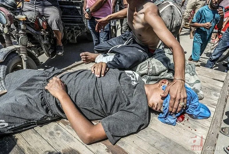 ABD'li doktor soykırımcı İsrail'in acımasızlığını herkese duyurdu: Karnından ve göğsünden vurulmuş çocuklar gördüm 12