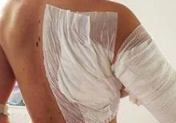 Asitli saldırıda ünlü model de yaralandı!