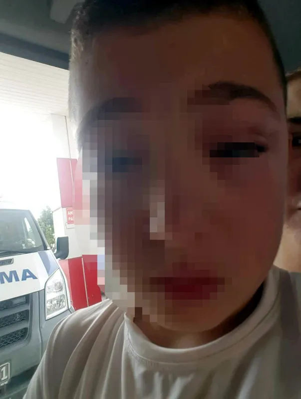 Oğluyla tartışan 9 yaşındaki çocuğu darp etti - 1