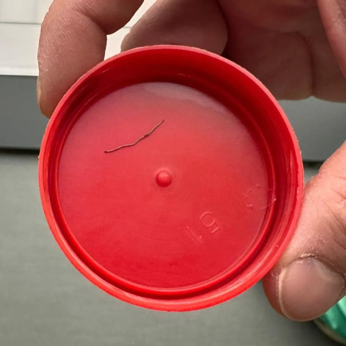 Bebeğin sırtından tel parçası çıktı