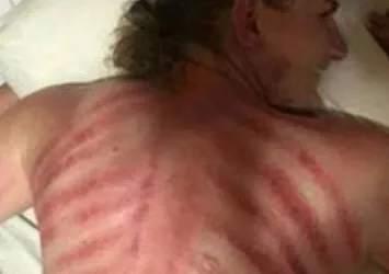 Turiste yapılan 'ejder masajı' kötü bitti