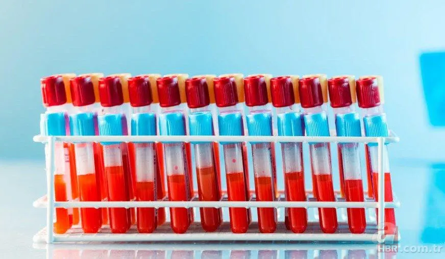 Hangi kan grubu nasıl beslenmeli? İşte kan grubunuza göre tüketmeniz gereken besinler... 6