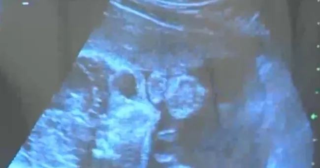 erken-dogumu-onleyecek-bakteri-tespit-edildi-risk-onceden-belirlenebilir-1629957724684.jpg Erken doğumu önleyecek bakteri tespit edildi! Risk önceden belirlenebilir - 2