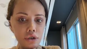 Yüz nakli olan Didem Ceran kansere yakalandı