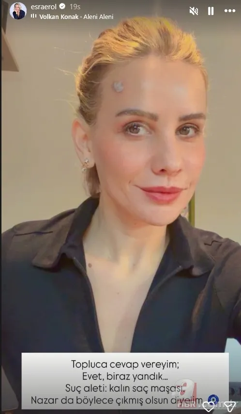 Esra Erol "nazar çıktı" deyip paylaştı! Canlı yayın öncesi görünmez kaza 2
