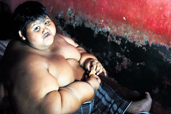 10 yaşında 190 kilo! - 1