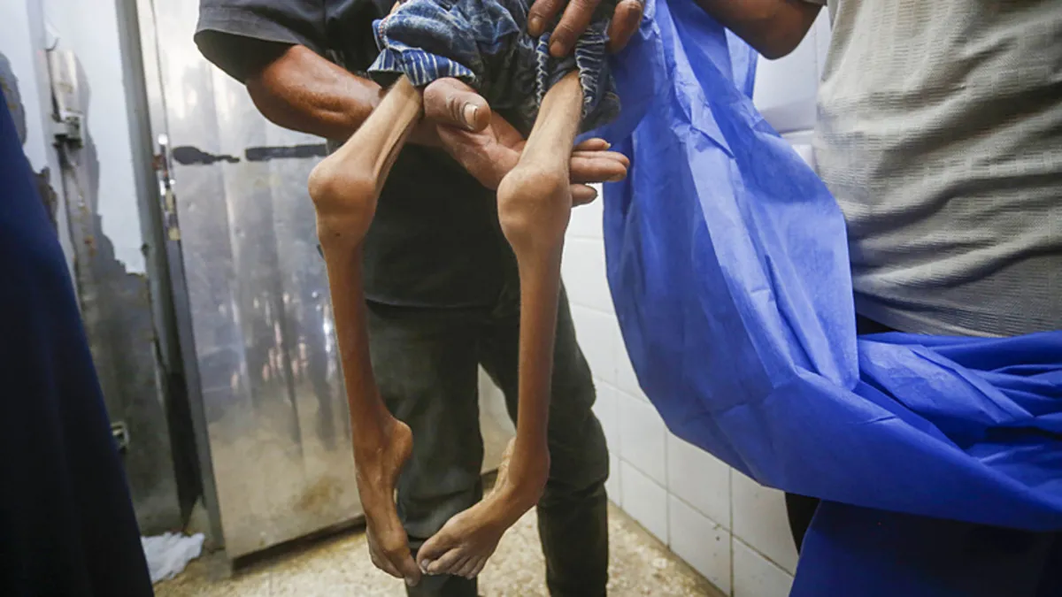 İnsanlık yerle bir... Gazze'de 6 kişi daha açlıktan can verdi!