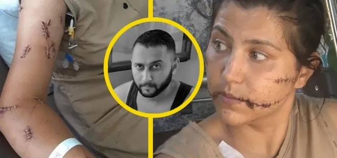 Cani koca çocuğunun gözü önünde dehşet saçtı: Karısını 104 yerinden bıçakladı