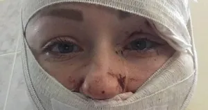 Falçatalı dehşette flaş gelişme