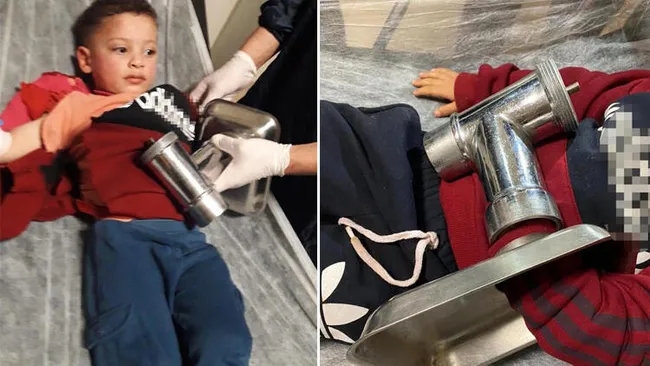 Eskişehir’de 3 yaşındaki Ahmet elini kıyma makinesine kaptırdı - 4