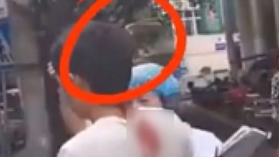 Kafasına saplı bıçakla tavırları şok etti