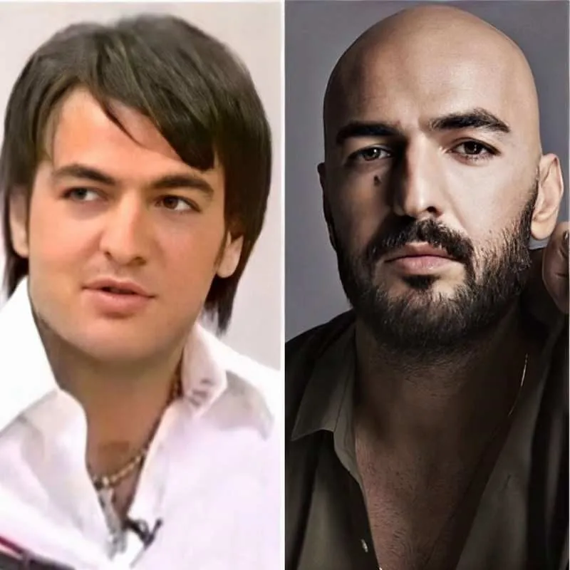 Masterchef Yarismacisi Barbaros Yologlu Nun Eski Hali Olay Oldu Kilolu Fotograflari Soke Etti