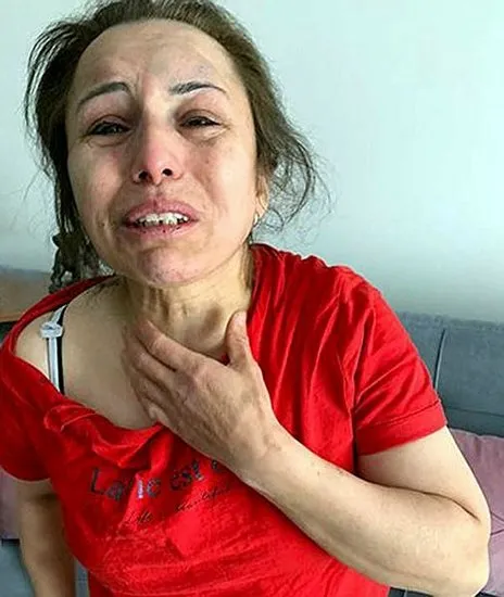 İstanbul eski koca dehşeti! Kaçırdı, dövdü, işkence yaptı ve ölümle tehdit etti - 3
