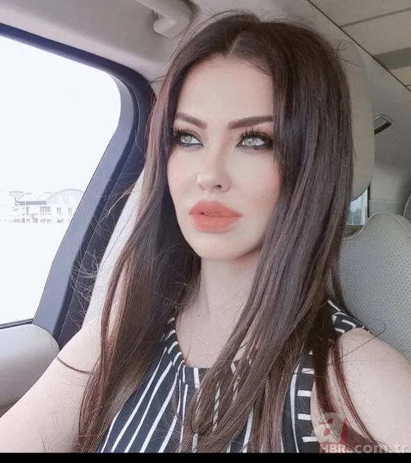 “Yüzümde hiç estetik yok” diyen Lara’nın eski hali şaşırttı 2