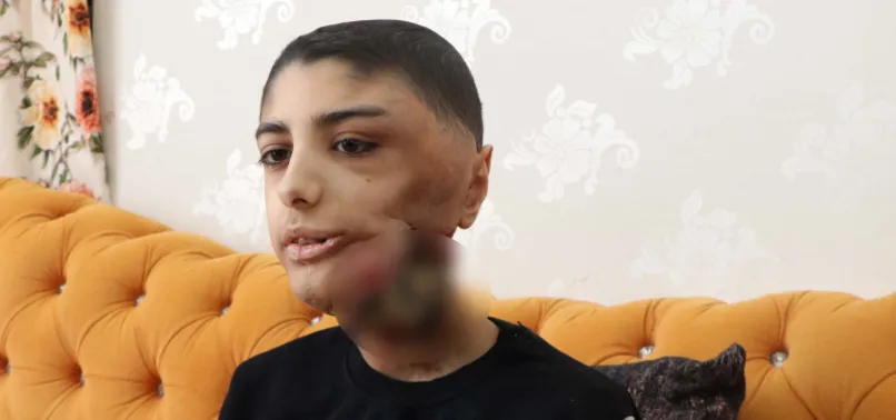 Çenesinin altına kadar indi! Yüzündeki yara her geçen gün büyüyor