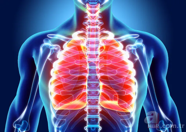 Akciğer kanseri belirtileri nelerdir? 1