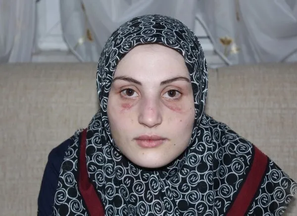 Kaçarak evlendi! Kocası hayatını zindana çevirdi: Tekme, tokat ve demir borulu şiddetine maruz kaldı! - 1