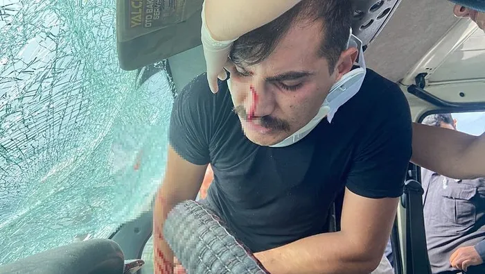 aksarayda-kaza-sonrasi-ilginc-anlar-canini-unuttu-yuzunun-derdine-dustu-yuzum-cok-mu-kotu-1714493346179.jpeg Aksaray'da kaza sonrası ilginç anlar! Canını unuttu: Yüzünün derdine düştü: 'Yüzüm çok mu kötü?' - 3