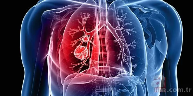 İşte kanseri tedavi eden besin! Mucizevi etkileri var 2