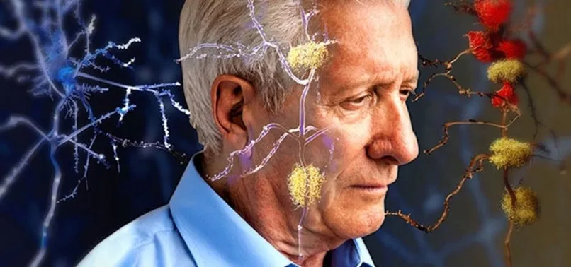 Sarki Soylemek Alzheimer I Onluyor A Haber Son Dakika Saglik Haberleri