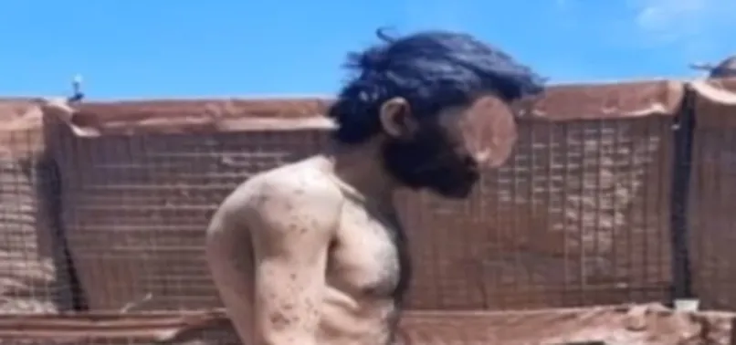 PKK'nın sözde üst kademesi sefa, alt kademe ise sefalet içinde! İşte teslim olan teröristlerin hali