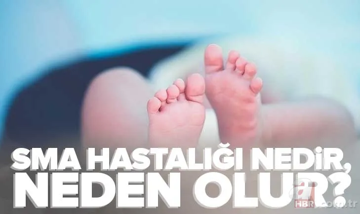 SMA hastalığı nedir, neden olur? Tedavisi var mı, belirtileri neler? SMA hangi yaşlarda kimlerde görülür? 1