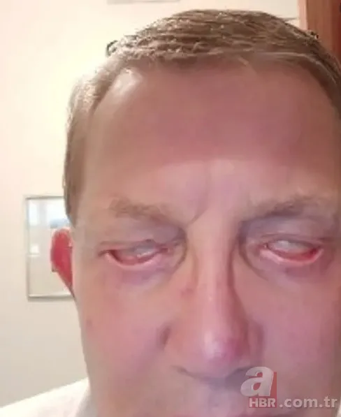 3 senedir gözlerini kapatamıyor! Sağlığına kavuşmak için Türkiye’ye geldi 10